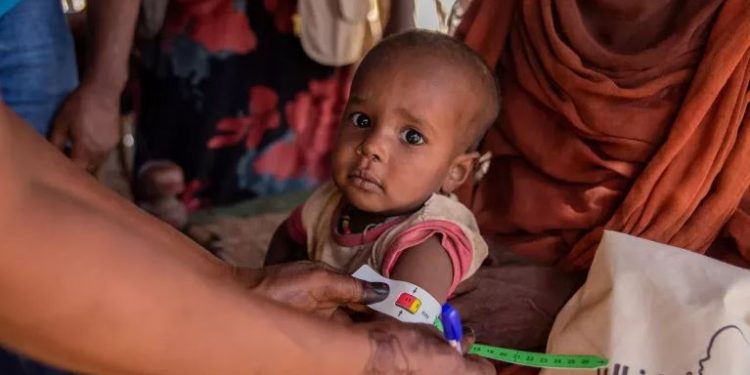 Sudani përballet me krizën më të rëndë humanitare në botë